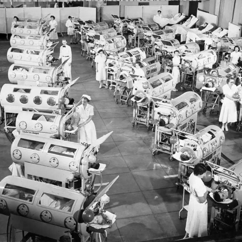 Filas de pacientes con polio