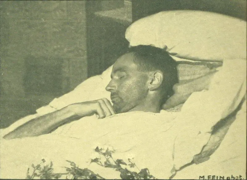 Postmortem photo of Egon Schiele